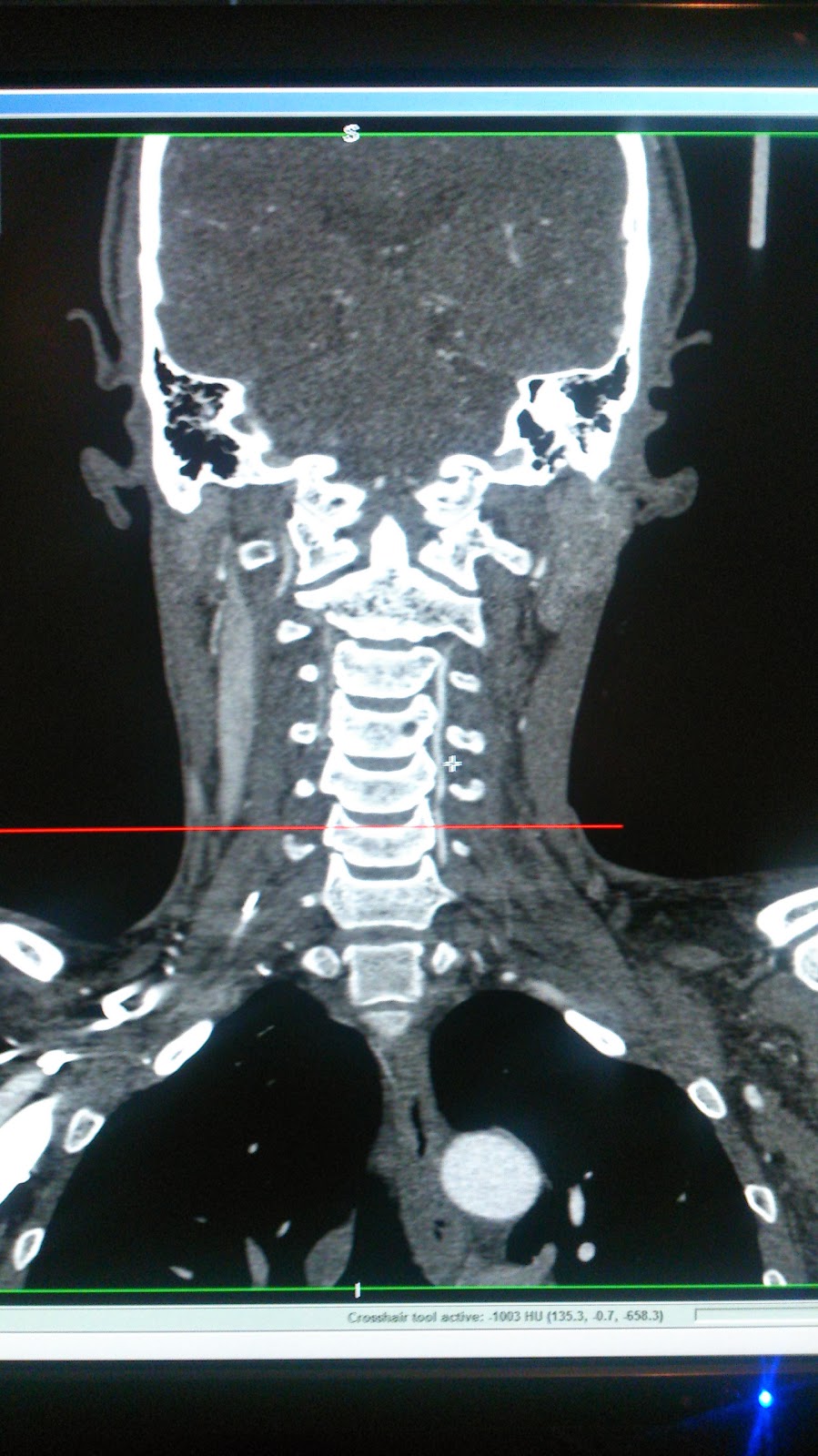 En smålänning på vift oktober 2013