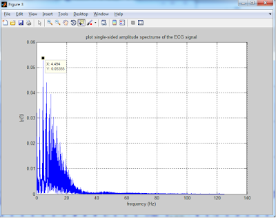 Biomedical Signal and Image Processing projects using Matlab and ...