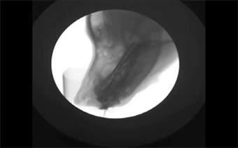 7. X-ray: Anjing yang sedang minum air putih 7. X-ray: Anjing yang sedang minum air putih