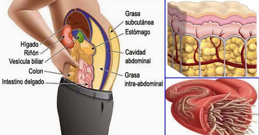 Del cuerpo parasitos quitar los como