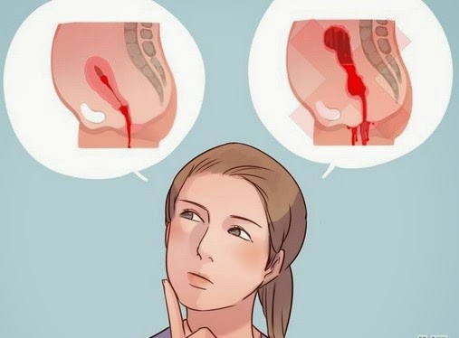 some causes of pregnancy early symptoms bleeding steps of pregnancy