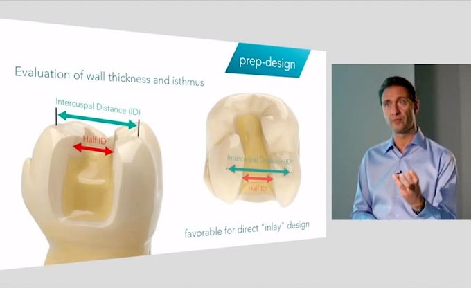 FIBRE REINFORCED COMPOSITES: A real break-through - Videoconferencing of Stephane Browet