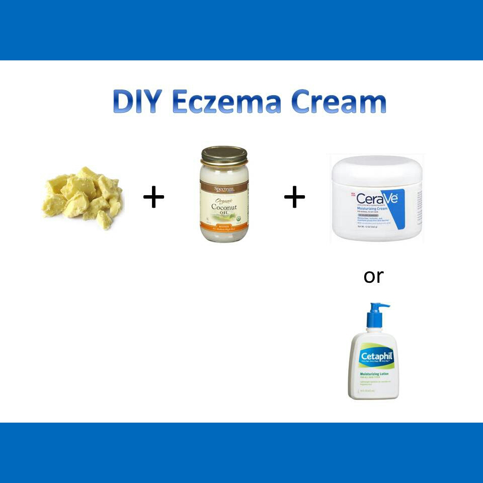 DIY Eczema Lotion