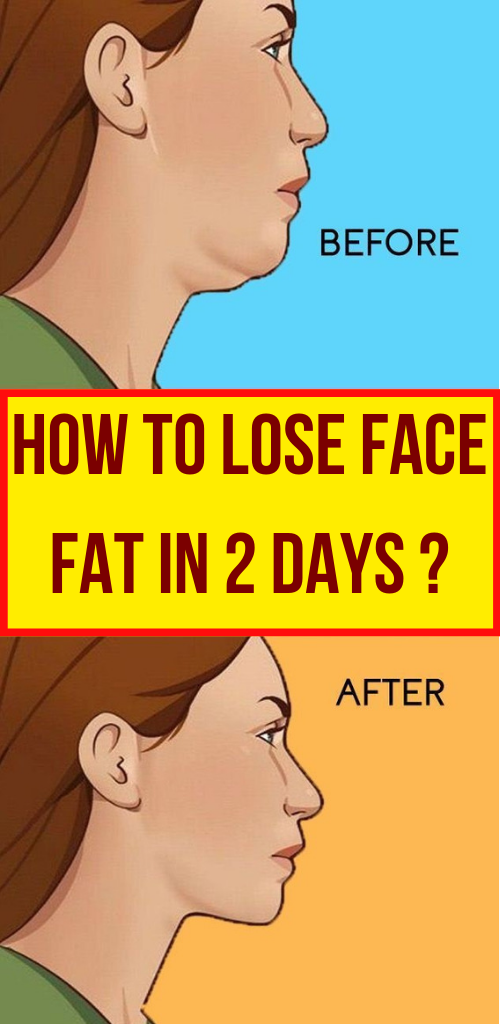 How to Lose Face Fat ?