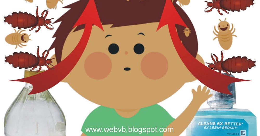 How to Get Rid of Lice with Vinegar and Listerine StepbyStep Home