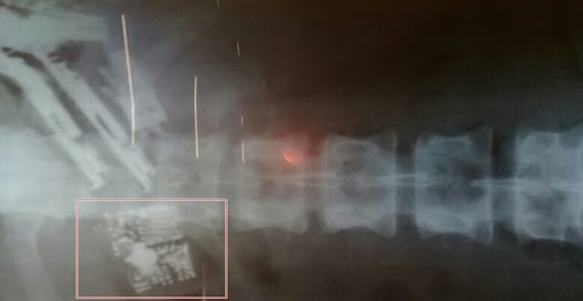 Preso engole cinco celulares e dois carregadores na saidinha do