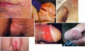Foto Gang Jie dan gho siah Obat Asli Denature