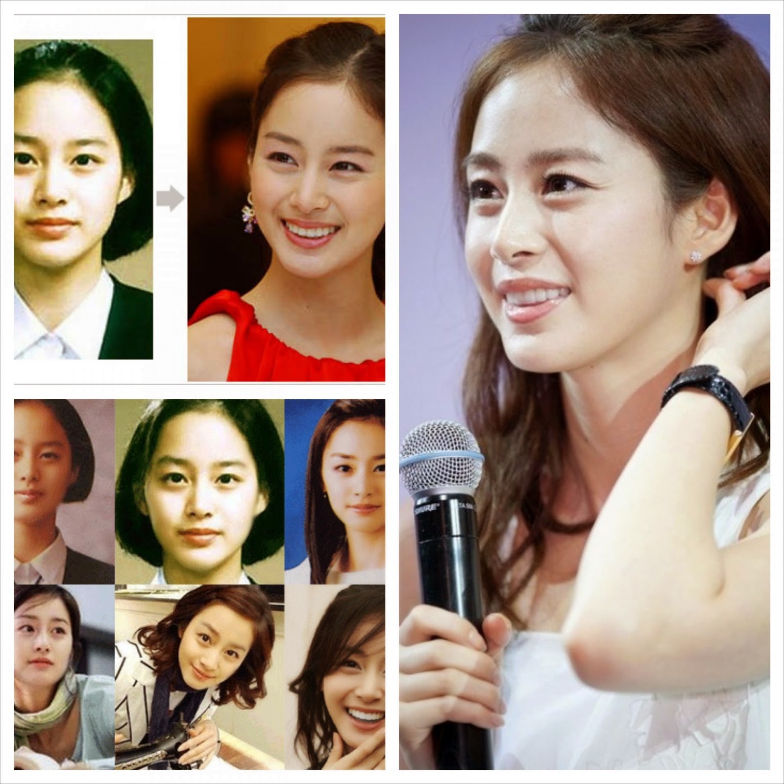 Korean actress kim tae hee plastic surgery before & after. 