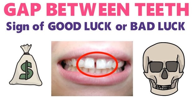 gap-in-teeth-good-or-bad