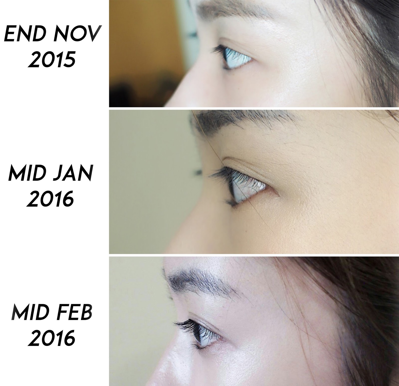 xlash vs xlash pro xlash vs xlash pro