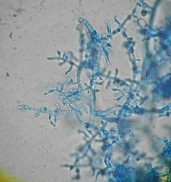 ATLAS MICOLOGIA: TRICHODERMA species