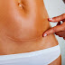 Reconstruye la pared abdominal, reduce la piel suelta y remodela sus caderas.