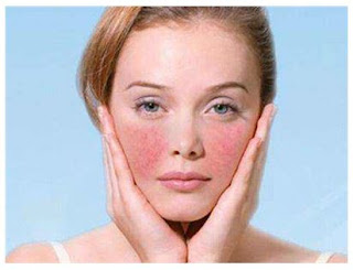 How to Heal and Soothe Irritated Sensitive Skin Irritated Sensitive Skin