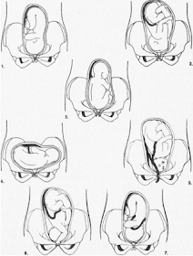 bebeğin anne karnındaki pozisyonları, anne rahminde bebeğin duruşları, bebek anne karnında nasıl durur