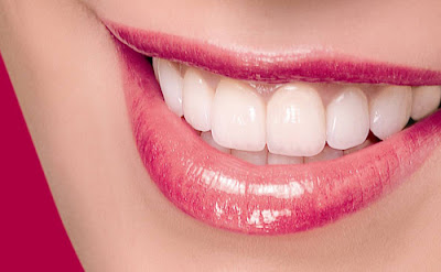 Bọc răng sứ có đau hay không?