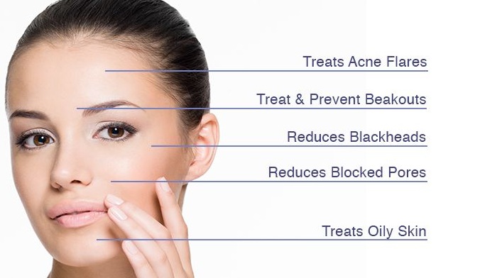 Best Acne Treatment for Teens You Need to Know - Feedtheking