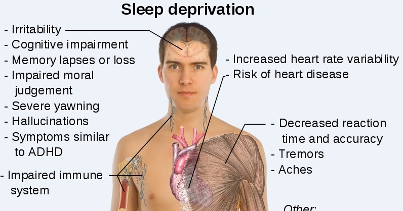 Signs And Symptoms Of Sleep Deprivation