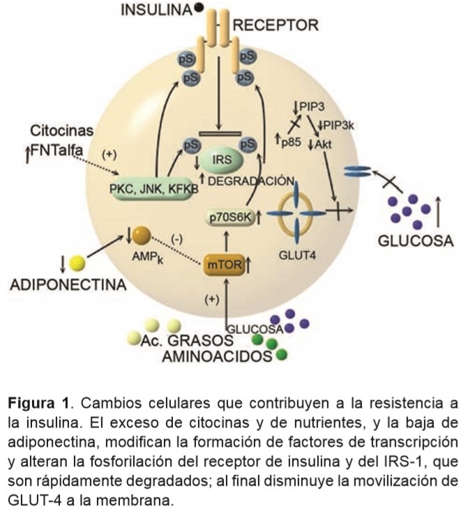 transcripción médica de diabetes