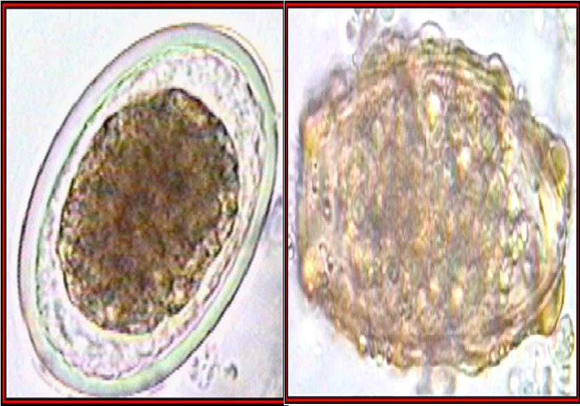 .: Medicina Islamica :.: Ascaris Lumbricoides
