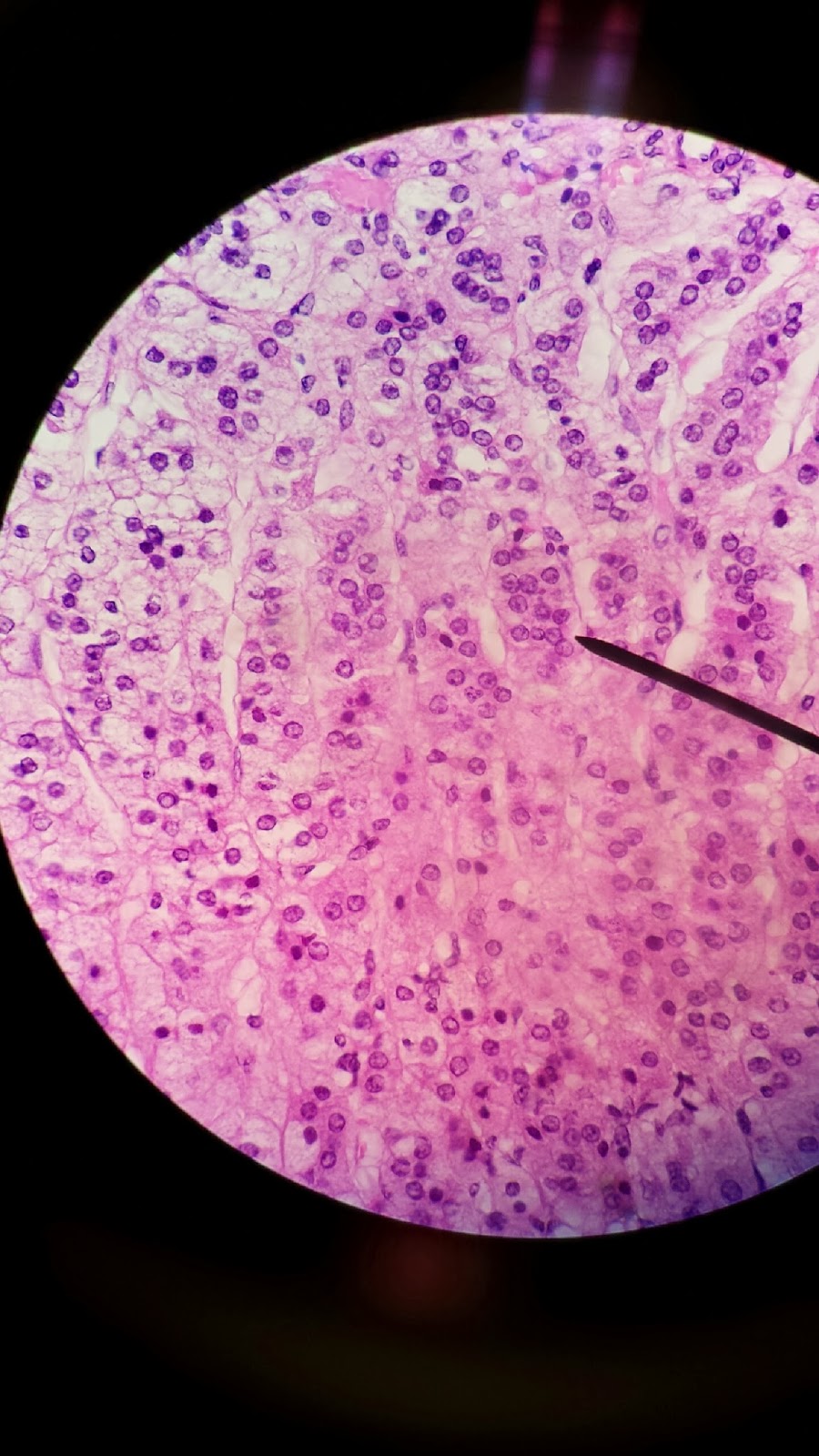 Histology: Adrenal Gland
