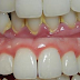 Rub These Two Oils On Your Gums And Teeth And You Probably Will Not Need To Go To Dentist Again