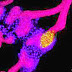 Creados por primera vez “mini-riñones” a partir de células madre
humanas