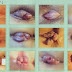 Obat Ambeien Herbal Tanpa Operasi thumbnail