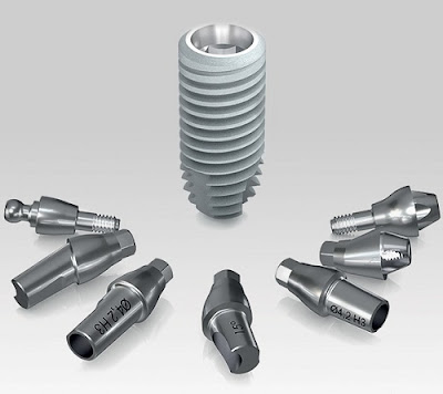 trong-rang-bang-cong-nghe-cay-ghep-implant.jpg