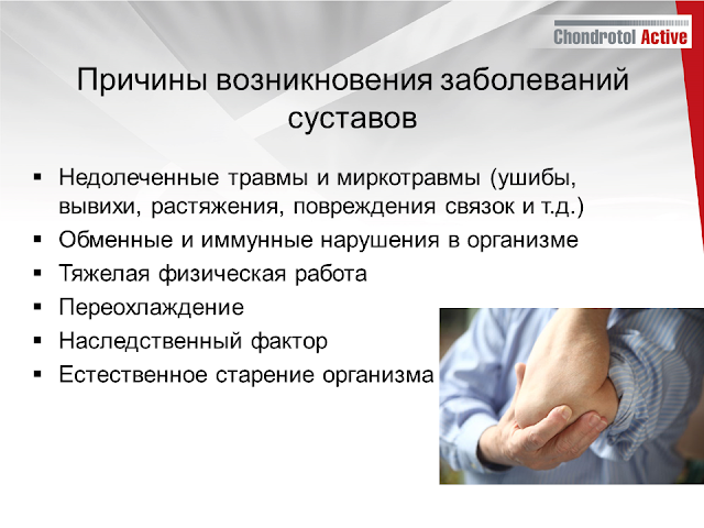 купить Артлайф Артлайф Беларусь в Гомеле, Минске, Бресте, Могилеве, Витебске, Гродно