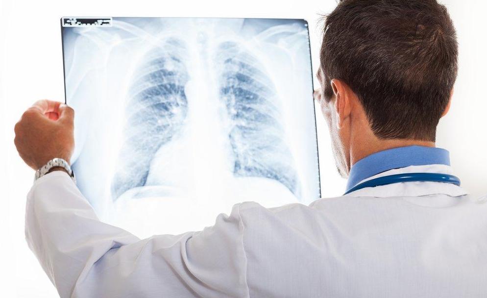 Lung Cancer Spread To Bones Life Expectancy