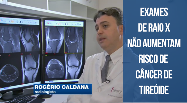 Atenção: exames de raio-x não aumentam o risco de câncer de tireoide Atenção: exames de raio-x não aumentam o risco de câncer de tireoide