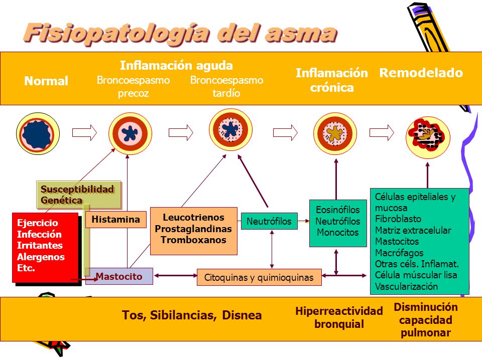 ASMA BRONQUIAL FISIOPATOLOGÍA DEL ASMA ASMA BRONQUIAL FISIOPATOLOGÍA DEL ASMA