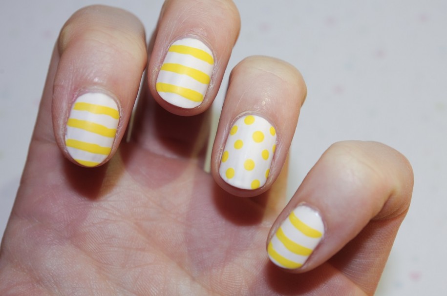 Yellow white nails!