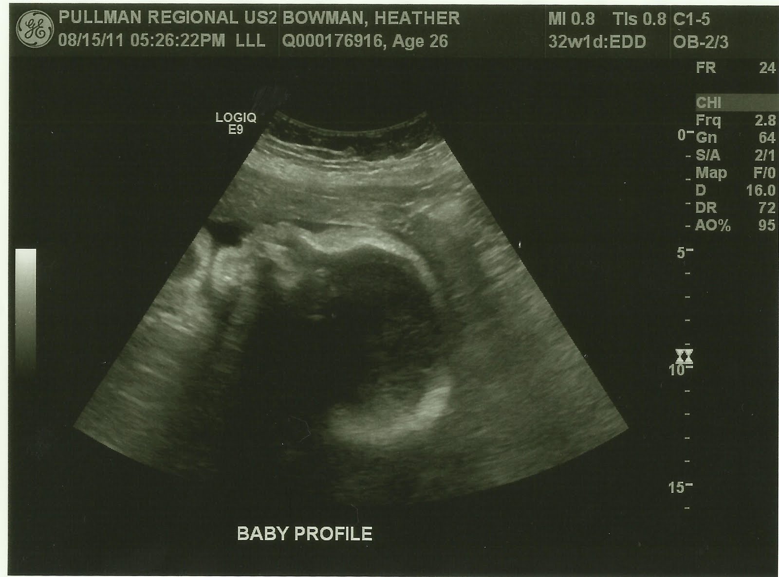 Bowman Family 32 Weeks 1 Day Ultrasound