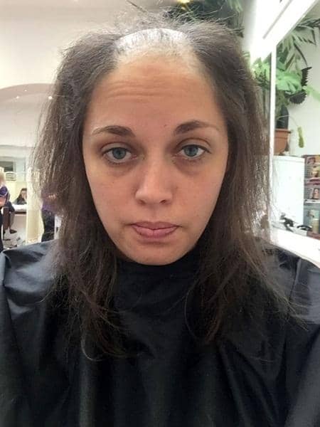 Suburkan Rambut Cukup Dengan 2 Bahan Dapur