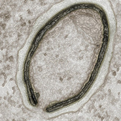 

The Pandoravirus

