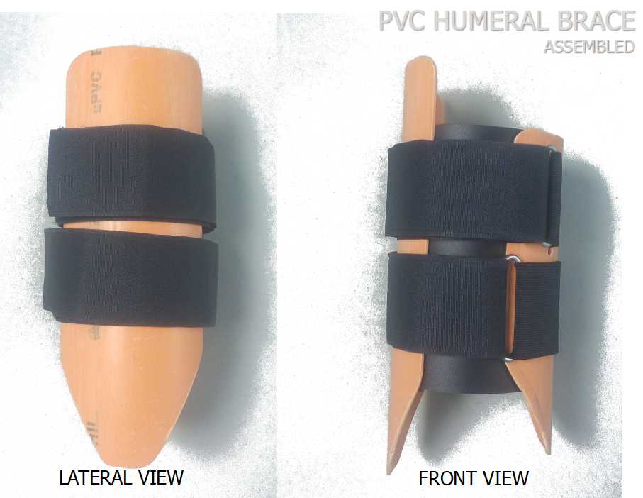 . MAKING HUMERAL FRACTURE BRACES USING PVC PIPES
