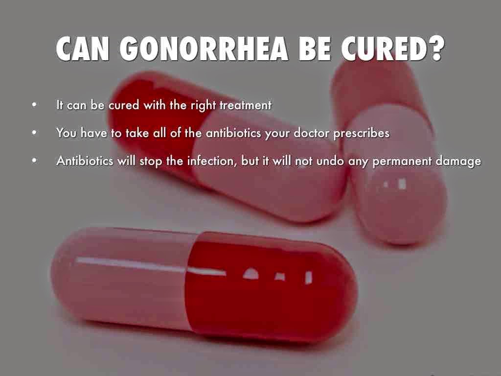can you cure gonorrhea at home can you cure gonorrhea at home
