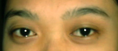 Tanda-penyakit-dalam-tubuh-yang-bisa-dilihat-dari-sekitaran-wajah_111.jpg Tanda-penyakit-dalam-tubuh_111.jpg