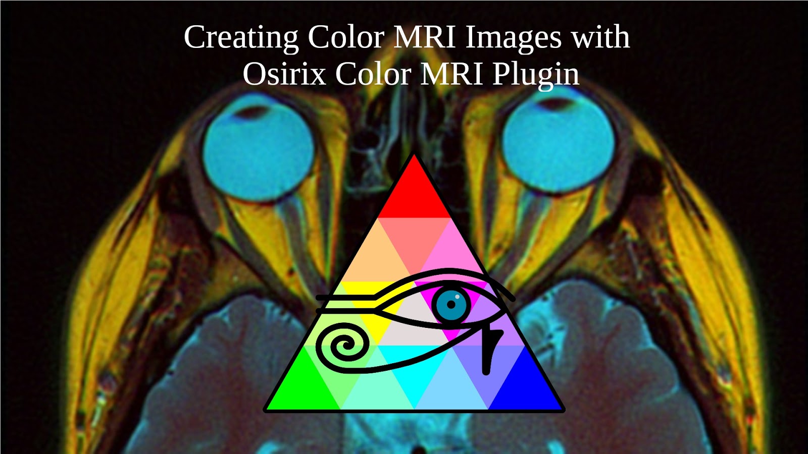 Nevit's blog Creating Color MRI images with Osirix Color MRI Plugin