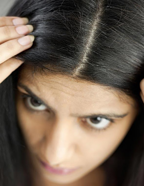 How-to-Prevent-from-Dandruff How-to-Prevent-from-Dandruff