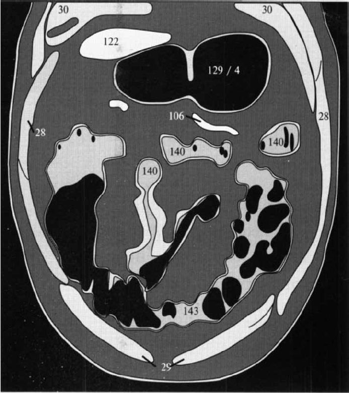 кт брюшной полости человека. кт брюшной полости человека. сагиттальный срез кт обп. кт брюшной полости человека. кт брюшной полости человека.