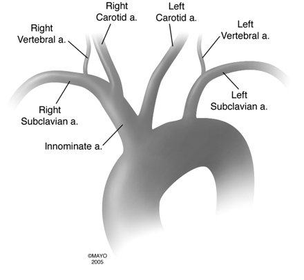 Innominate artery diagram artery diagram scalp innominate artery diagram artery diagram scalp