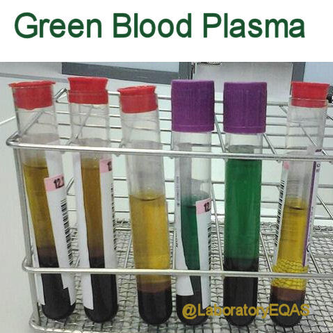 Medical Laboratory and Biomedical Science: Green Blood Plasma