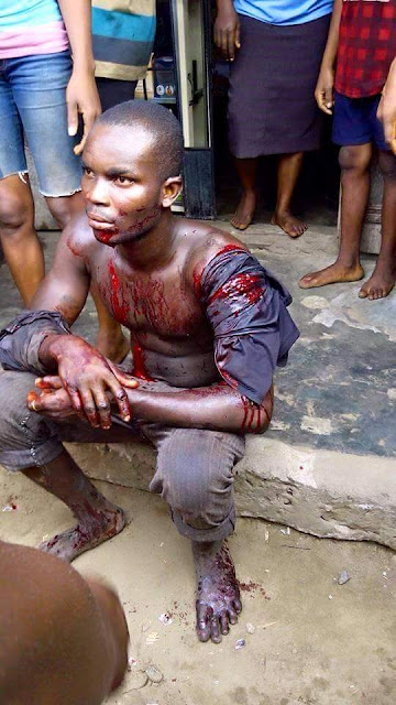  Man Attacked By Fulani Herdsman In His Farm In Delta (Graphic Pics)  Hdn