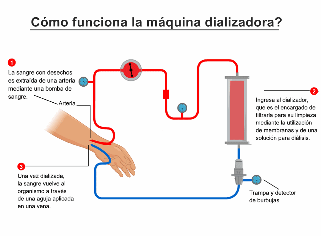 Dialysis machine Diagram