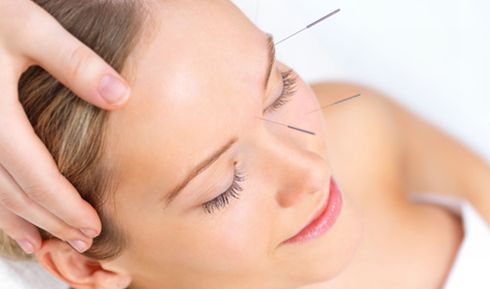 http://4.bp.blogspot.com/-nfUa41Nqyok/UWSGfz4nyGI/AAAAAAAAAOQ/ZxCN0NBuV48/s1600/Benefi%CC%81cios-da-Acupuntura-para-a-Este%CC%81tica.jpg