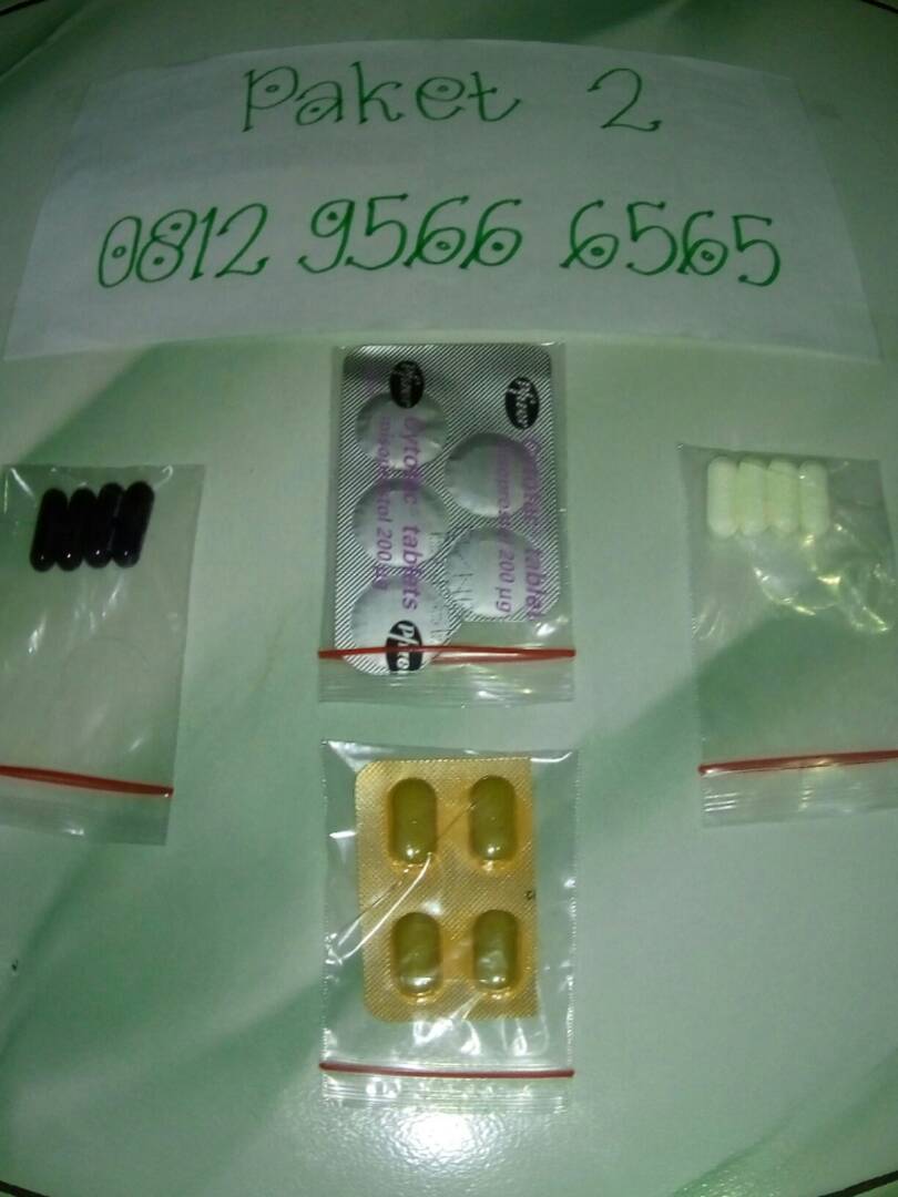 Gambar Bayi Aborsi Usia 1 Bulan