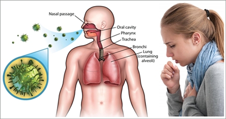 Penyakit pernapasan.