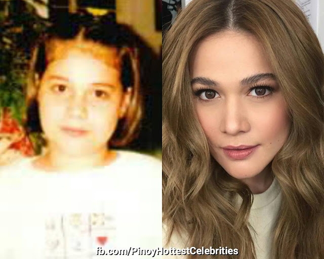 21 Before And After Photos Of Filipino Celebrities